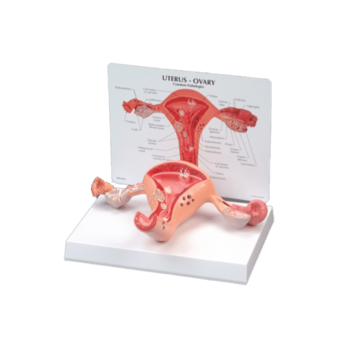 Female reproductive system model