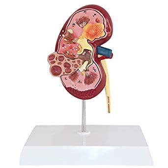 Kidney model