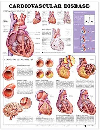Cardio-Vascular chart