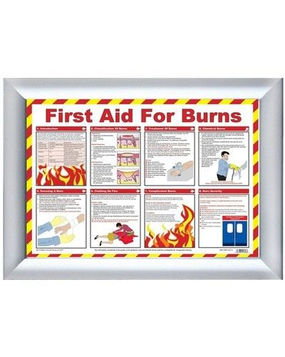 First aid for burns chart