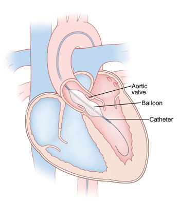 Cardiac pulmonary Children chart