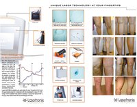 Lasotronix Laser For VARICOSE VEIN 1470nm/15W, Usage: Hospital