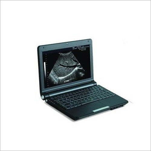 Laptop Ultrasound Scanner