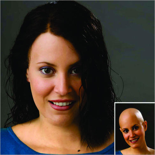 Hair Wigs for Burnt Patients - Accidental Patients for Women