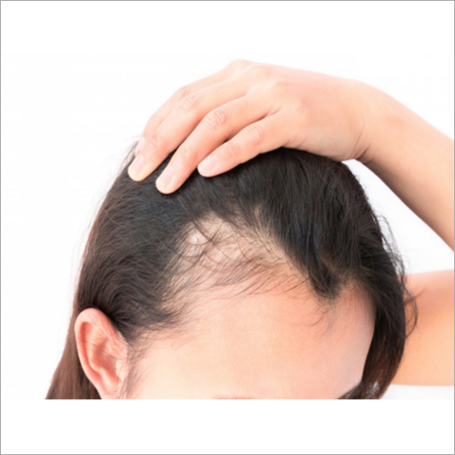 Platelet Rich Plasma - PRP for Hair Regrowth