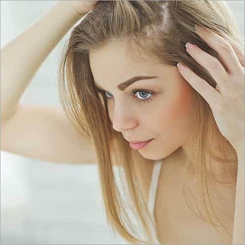 Integration System for Hair Replacement