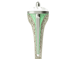 Endo Model Rotational Knee Prosthesis (Rotating Hinge Knee)