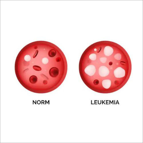 Leukemia - Blood Cancer Natural Herbal Treatment Services Without Side Effects
