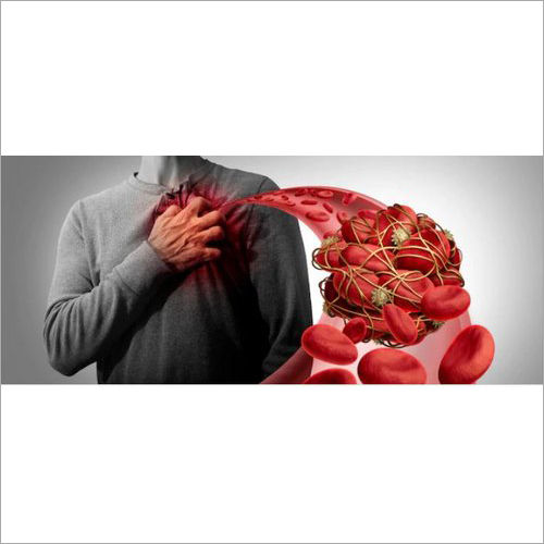 Heart Artery Blockage Clear Natural Herbal Treatment Services Without Side Effects