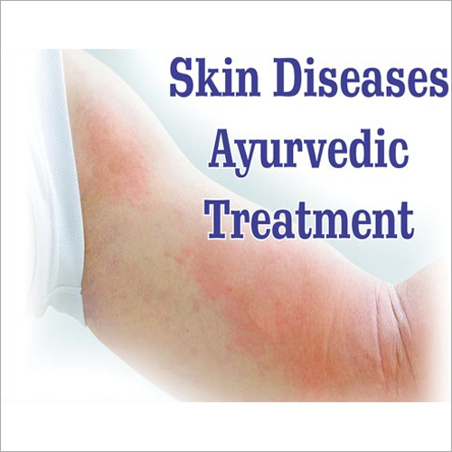 Ayurvedic Treatment For Skin Diseases
