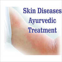 Tratamiento de Ayurvedic para las enfermedades de la piel