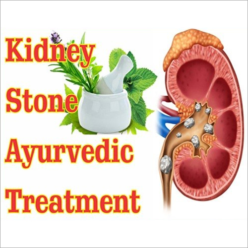Ayurvedic Treatment For Kidney Stone