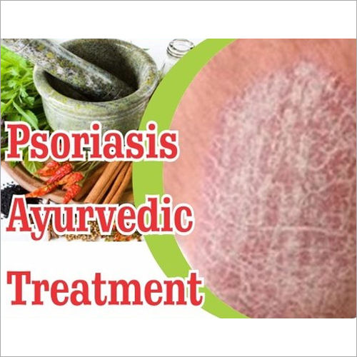 Ayurvedic Treatment For Psoriasis