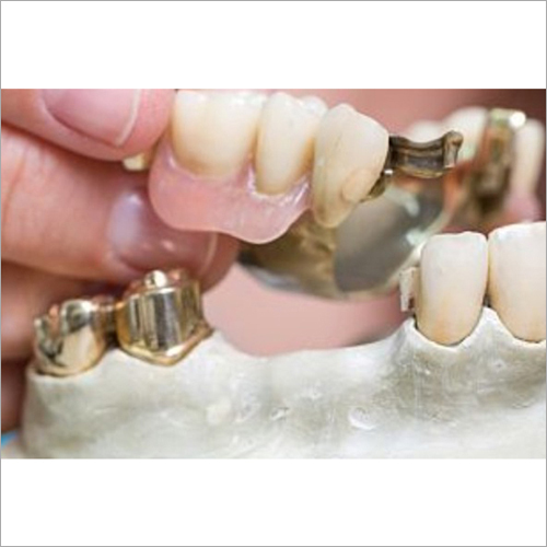 Dental Cobalt Chromium Stent Casting Alloy Columnar