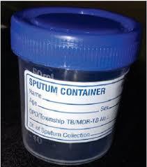 Labcare Export Urine Container