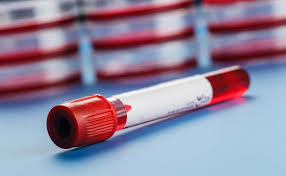 Vaccum Blood Collection Tube