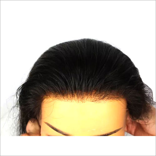 Lace Closure Hair