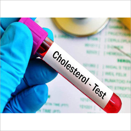 Cholesterol Testing Services