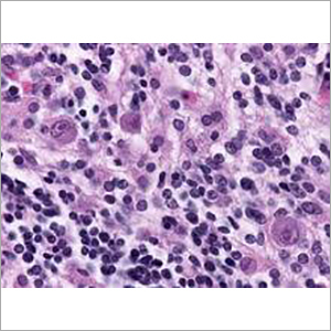 Giemsas Stain