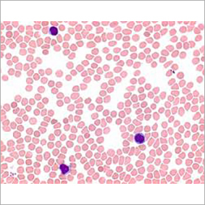 May & Grunwalds Stain