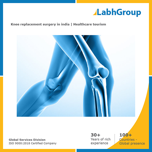 Knee Replacement surgery in India  Healthcare tourism