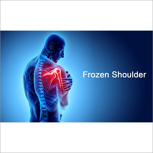Frozen Shoulder Treatment Services