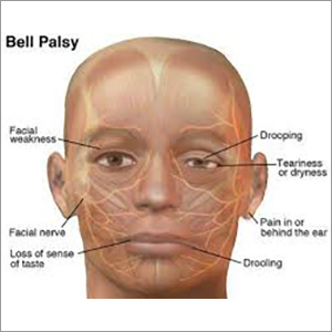 Bell's Treatment Services