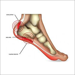 Heel Pain Treatment Services
