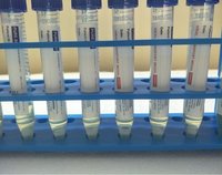 Vtm Kit - Plastic Material, 1 Reaction Per Kit | Viral Transport Medium, Test Tube, Swab