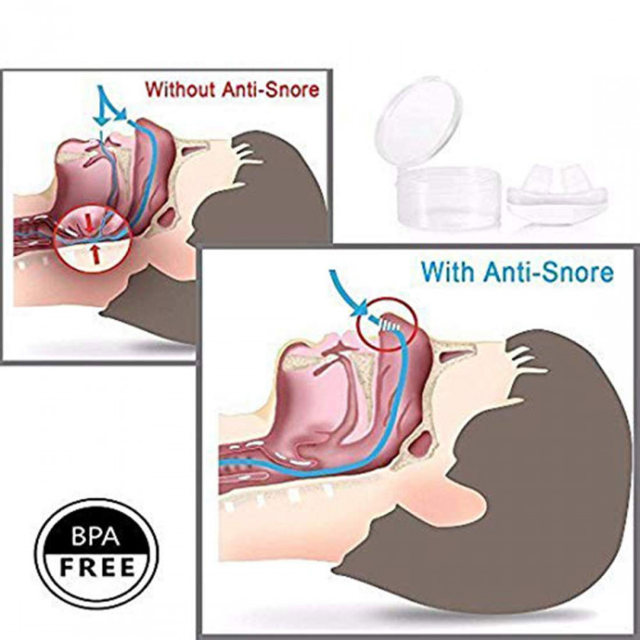 2 IN 1 SNORE NOSE CLIP