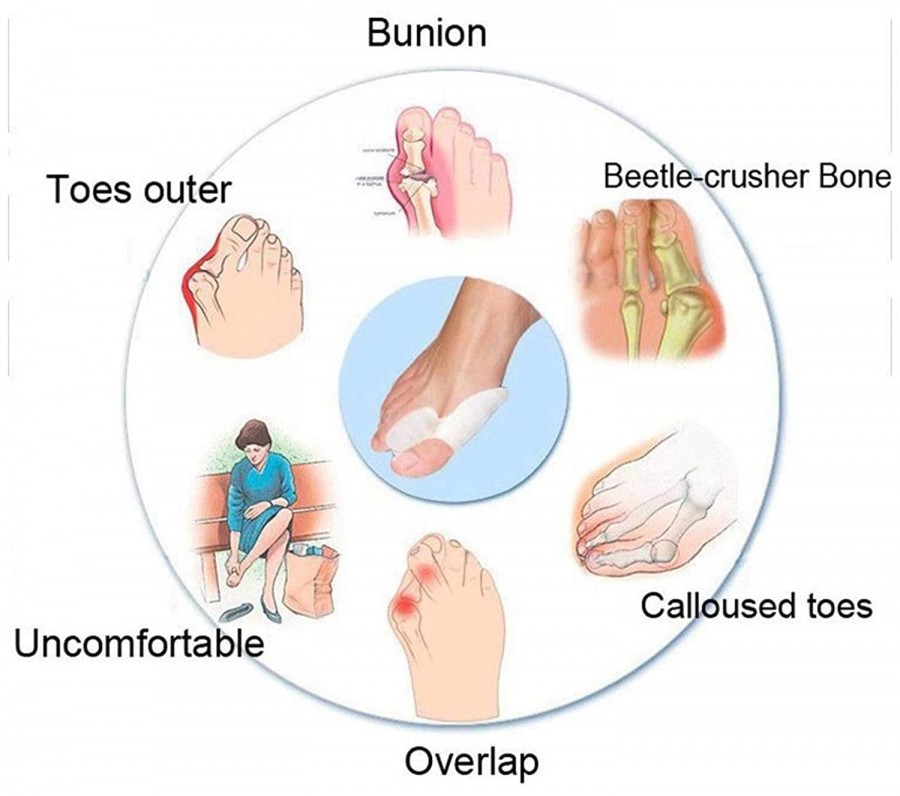 ANTI CRACK TOE PROTECTOR SILICON