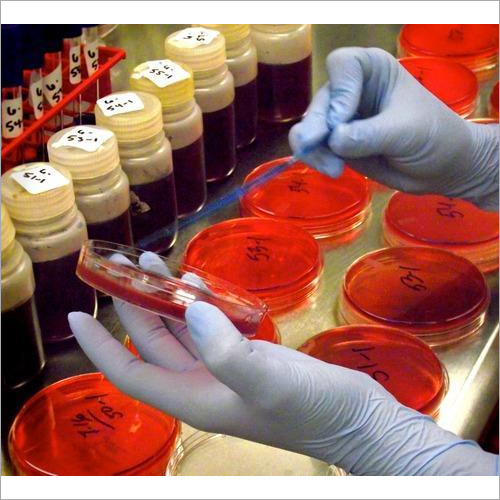 Pathogen Testing Services By LILABA ANALYTICAL LABORATORIES