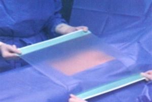 PU Fixable Drapes Adhesive Incise Drape