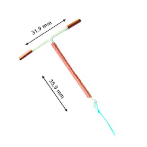 Intrauterine Copper Device