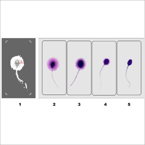 Sperm DNA Fragmentation Test