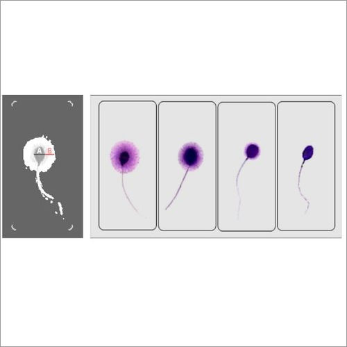 Sperm Function Test Analysis