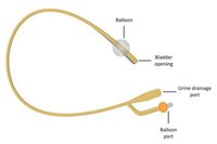 Urethral Catheter Grade: Medical Grade