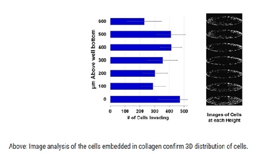 à¤¸à¥à¤² à¤à¤à¥à¤°à¤®à¤£ à¤ªà¤°à¤ (3D)