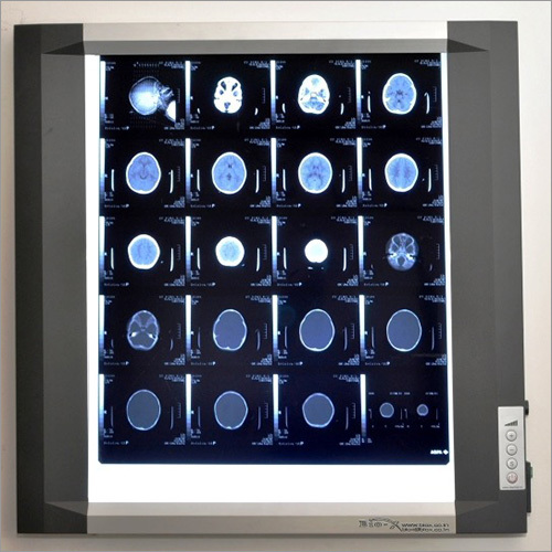 X-Ray View Box