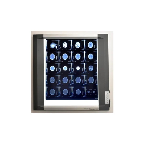 X-Ray View Box