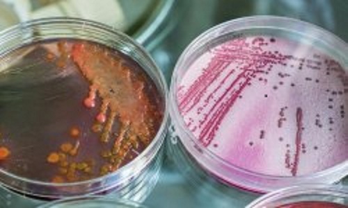 Anti Microbial, Anti Fungal Testing