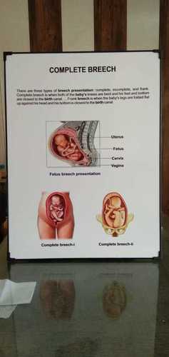 Breast Changes in Pregnancy Chart - Laminated, With Rollers, 51×66 cm,  English only - TeachingNest