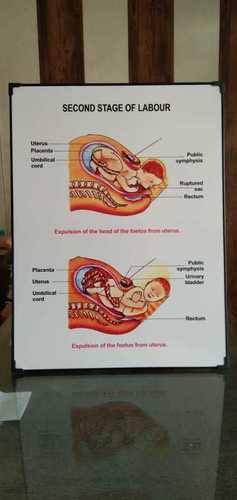 Chart Of Second Stage Of Labour