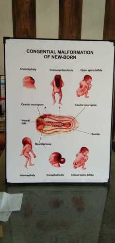 CHART OF MALFORMATION OF NEW BORN