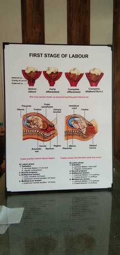 Chart of First Stage Of Labor