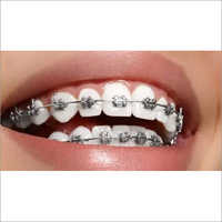 Teeth Braces No
