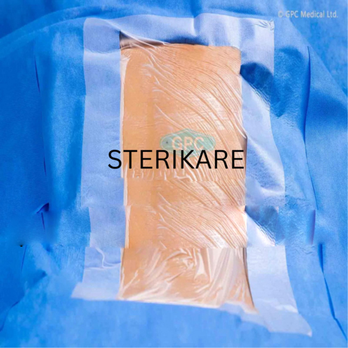 Spinal Drape - Application: Surgical Procedures