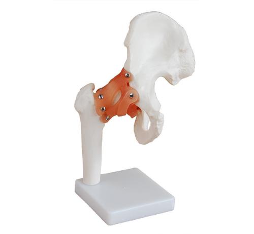 ConXport Life-Size Hip Joint