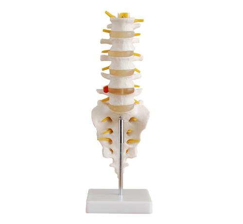 ConXport Life-Size Lumbar Vertebrae with Sacrum & Coccyx and Herniated Disc By CONTEMPORARY EXPORT INDUSTRY