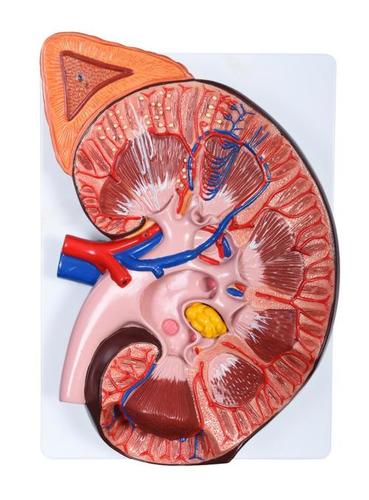 ConXport Enlarged Kidney Model 1 Part